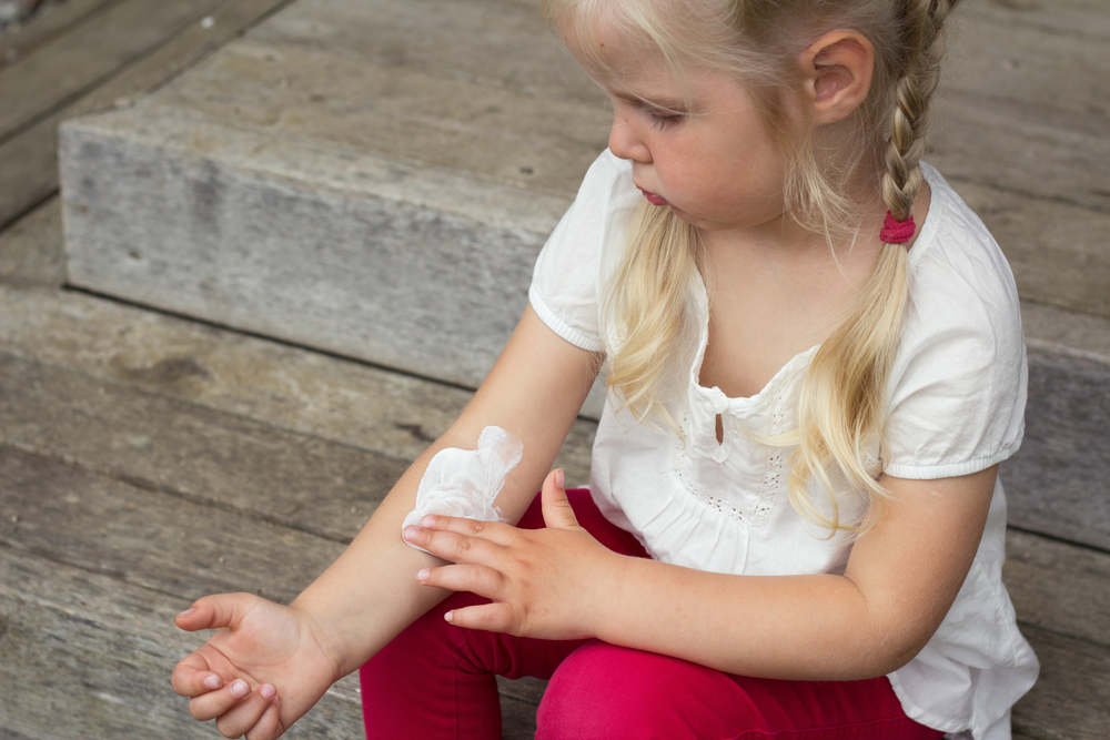 How to Manage Your Child’s Latex Allergy