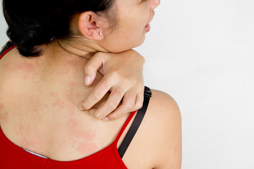 Clothing Allergy: 5 Reasons, 7 Symptoms, and 6 Ways to Control