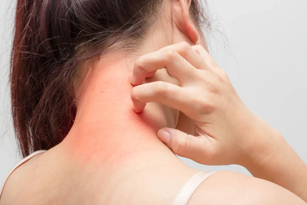 Person scratching red irritated neck skin, allergy reaction, need for hypoallergenic clothing