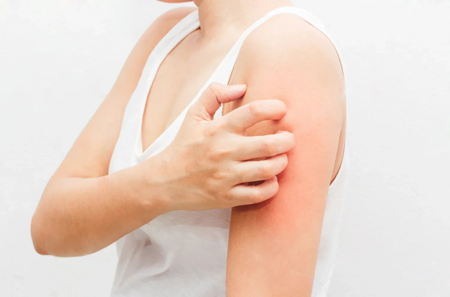 Person in white tank top scratching red, irritated arm, showing clothing allergy symptoms