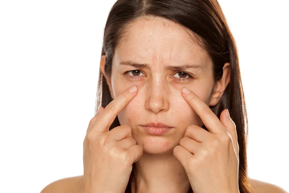 Woman with sensitive skin pointing to eye area, concerned facial expression, close-up