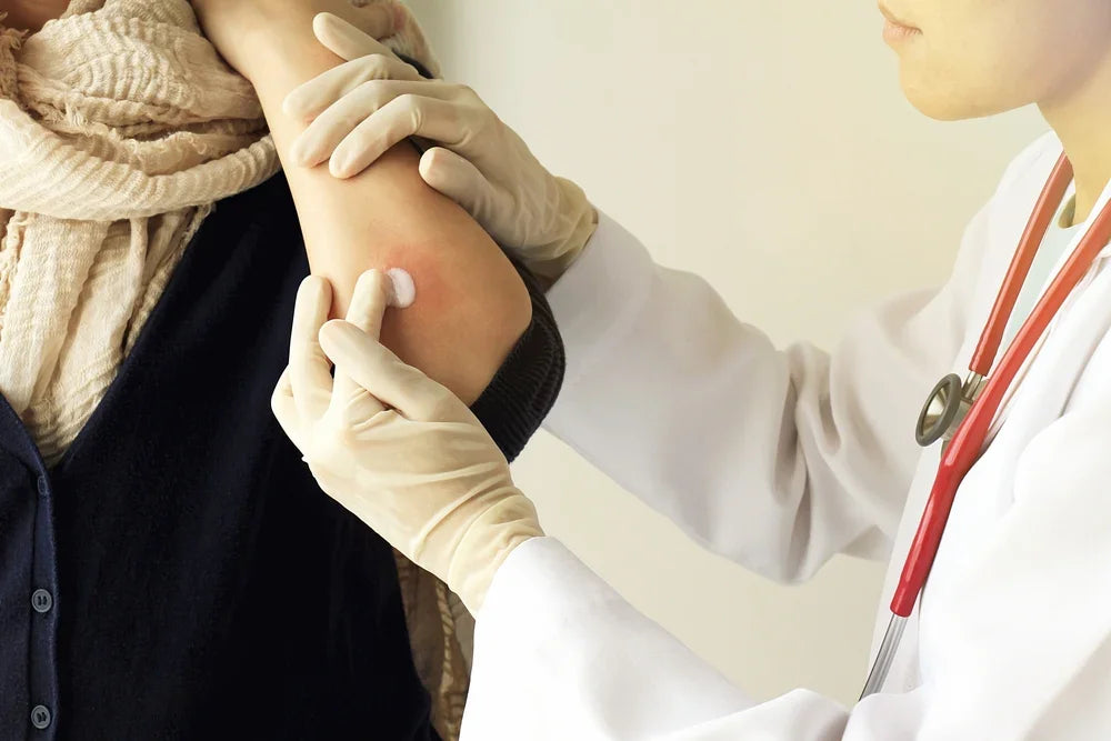 Doctor applying cream to eczema on patient's elbow, skin allergy treatment concept