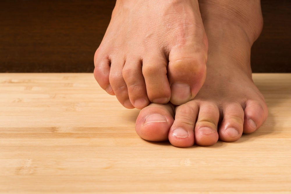 Quick Home Remedies to Soothe Dry Itchy Feet