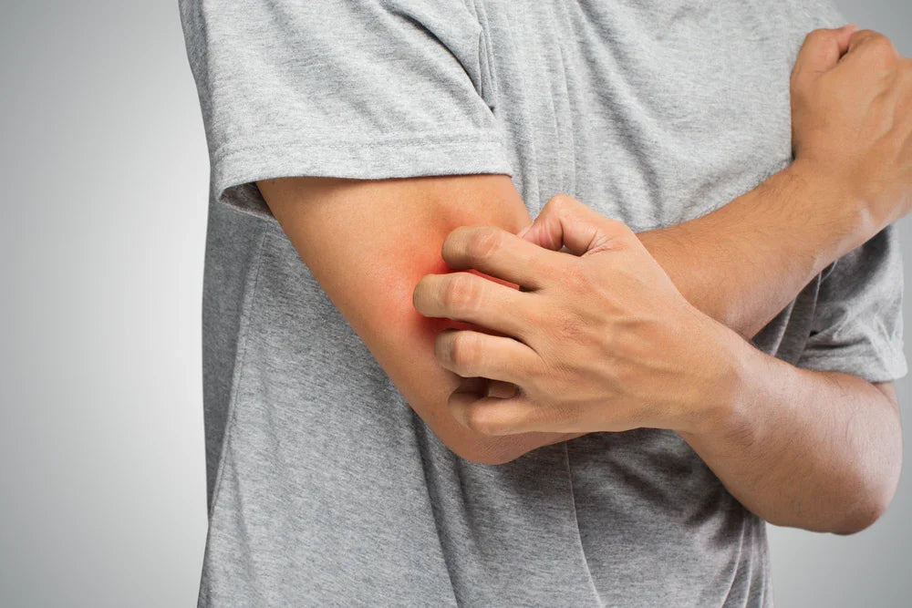 Person in grey shirt scratching red irritated skin on arm, eczema or sensitive skin issue