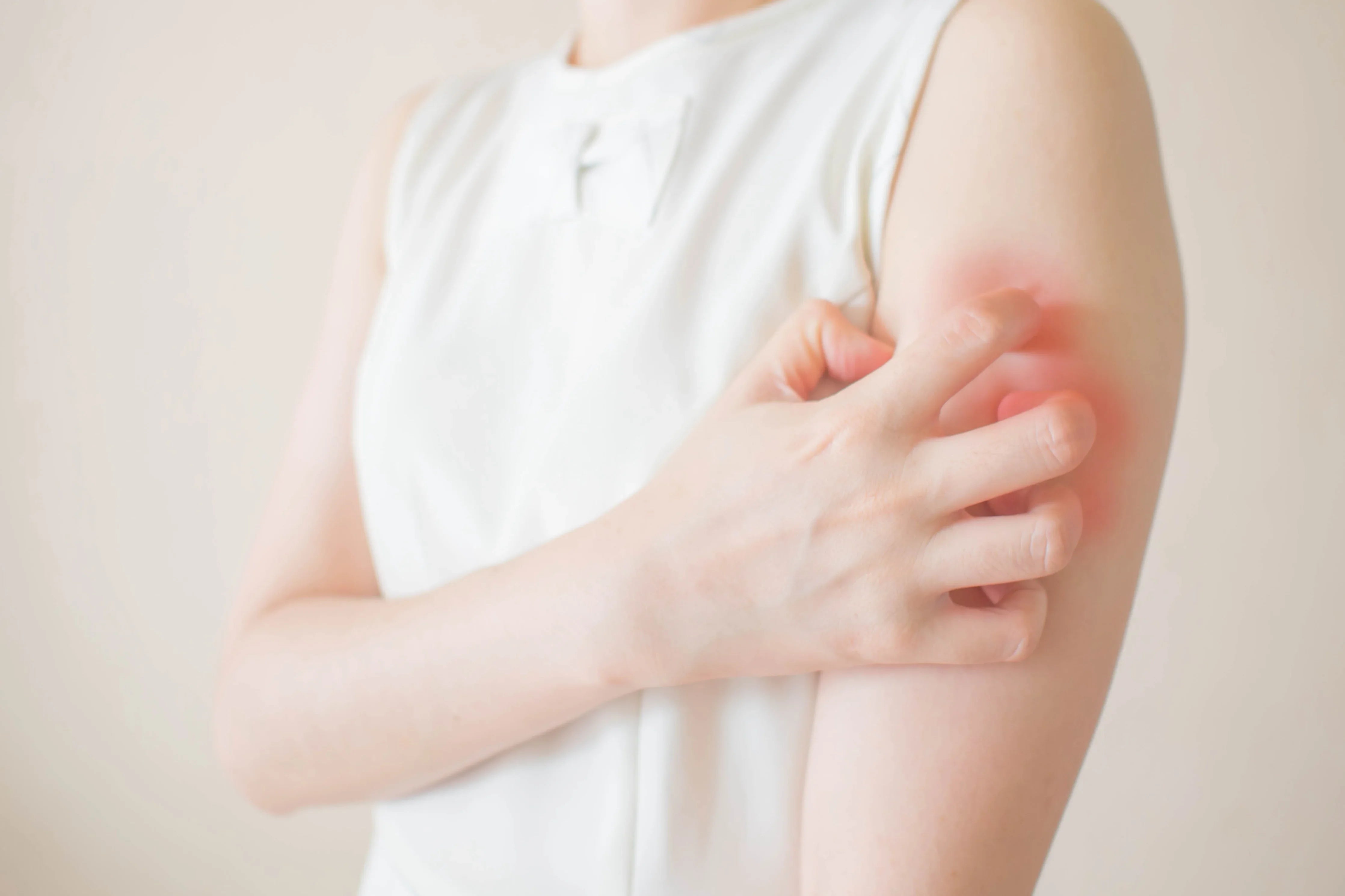 Person scratching red, irritated skin on arm, symptom of eczema or sensitive skin.