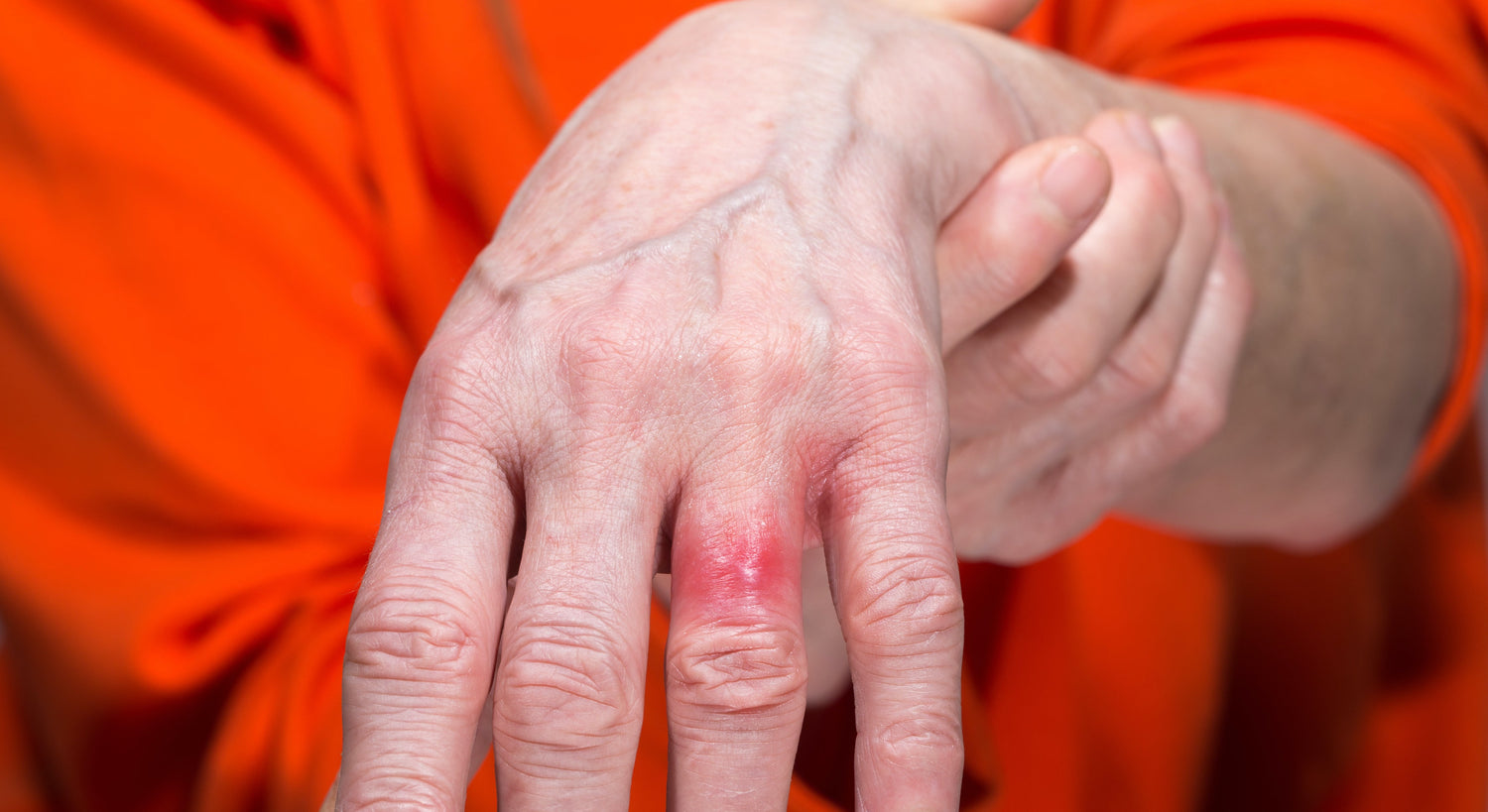 4 Essential Tips to Avoid Nickel Allergy